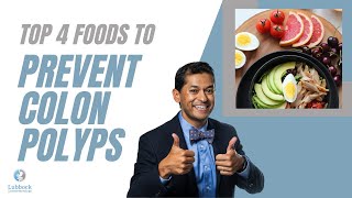 Foods that prevent polyps colon edition [upl. by Oesile970]