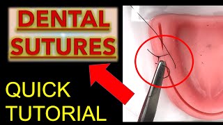 ALL SUTURES Tips to LEARN FAST Dental Suture Techniques  Oral Surgery  Dentistry Suturing [upl. by Rex]