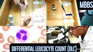 Differential Leucocyte Count DLC Practical  MUHS  mbbs physiology hematology [upl. by Lonyer]