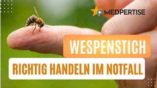 Allergie bei Wespenstich Richtig handeln im Notfall  so musst du reagieren [upl. by Eiggem]