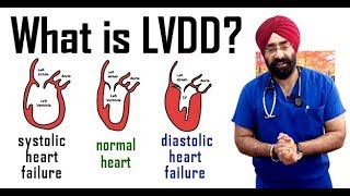 Rx Heart 19 Hindi क्या होता है Grade 1 LVDD Mild Diastolic Dysfunction Failure  DrEducation [upl. by Doner]