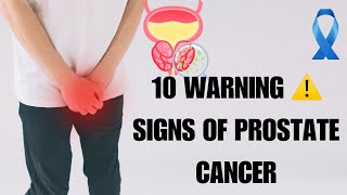 Dont Ignore These Prostate Cancer Symptoms [upl. by Odlanar]