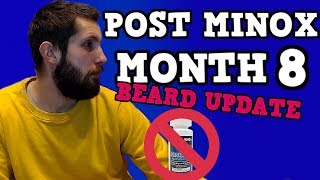 Post Minoxidil Beard Journey Update  Month 8  postminoxjourney [upl. by Hoehne944]