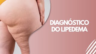 Diagnóstico do Lipedema [upl. by Nwahser]