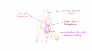 Signs and symptoms of hypoxemia [upl. by Monagan]