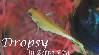 Dropsy in Betta Fish  Symptoms Prevention Life Expectancy amp More [upl. by Algy]