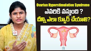 Dr Usha About Ovarian Hyperstimulation Syndrome  Ferty9 Fertility Centre [upl. by Lasko]