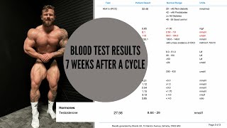 Blood Test Results 7 weeks After Steroid Use 250lb physique update [upl. by Harihs]