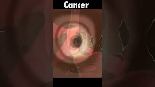 What cause esophageal cancer  esophageal esophagealcancer likeandsubscribe likesharesubscribe [upl. by Nnyre]