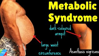 Metabolic Syndrome  Syndrome X – Symptoms Causes Diagnosis Treatment amp Prevention [upl. by Louie]