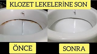 KLOZET LEKELERİNE SON👍 Çıkmayan Sarı Lekeleri  Kirleri Nasıl Çıkardım❓️ Mutlaka Deneyin 👍 [upl. by Idisahc772]