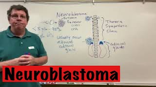 Neuroblastoma [upl. by Parnas]