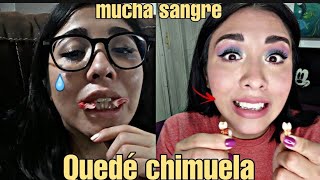 Mi extracción de premolares Quede chimuela🦷 [upl. by Sinned]