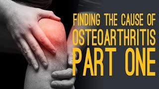 Finding The Cause of Osteoarthritis with Dr Li [upl. by Ycniuqed]