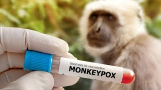 Everything you want to know about Monkey pox before the disaster  Dr Tee [upl. by Yenterb]