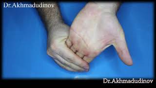 Treatment of joints with arthrosis of the hands [upl. by Ydnelg226]