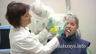 How to take dental xrays with bisecting angle positioning [upl. by Odrautse999]