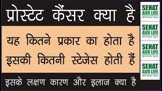 प्रोस्टेट कैंसर क्या है यह कितने प्रकार का होता है लक्षण कारण इलाज Prostate Cancer Symptoms Causes [upl. by Melac]