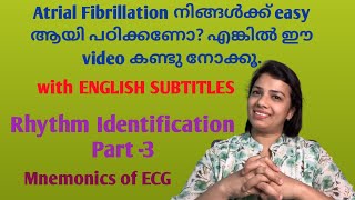 How to identity Atrial Fibrillation Easy way in malayalam for nursesRhythm Identification Part3 [upl. by Anaul]