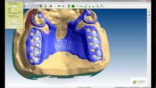 Logiciel CAO DIGISTELL pour la création de châssis squeletté pour prothésistes dentaires Part 2 [upl. by Aracat]