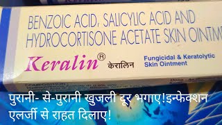 पुराने से पुराने खुजली त्वचा रोग को खत्म करें Keralin Ointment use in psoriasis And Fungicidal [upl. by Vadnee]