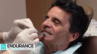 Prothèse amovible  Travail du dentiste et prothésiste  Dr SUBA Hongrie [upl. by Elata394]