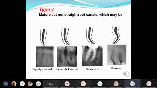 Endo lec1 [upl. by Adorl]