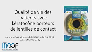 Qualité de vie des patients avec Kératocône porteurs de lentilles de contact [upl. by Vyky]