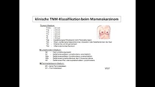 klinische Stadieneinteilung beim Mammakarzinom TNMStadium  Strahlentherapie Prof Hilke Vorwerk [upl. by Neelyahs]