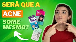 ADESIVO HIDROCOLOIDE PARA A ACNE FUNCIONA [upl. by Rudd]