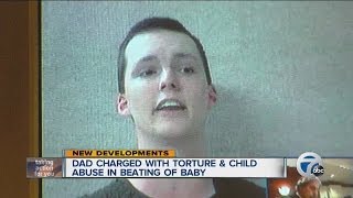 Dad charged with torture and child abuse in beating of baby [upl. by Soalokin]