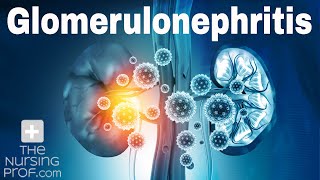 Renal Emergencies Glomerulonephritis [upl. by Cati]