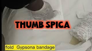 how to do thumb spica cast [upl. by Cleary202]