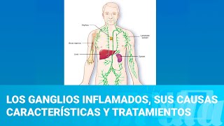 Los ganglios inflamados sus causas características y tratamientos [upl. by Nylevol]