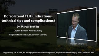 Dorsolateral TLIF indications technical tips and complications [upl. by Kcirrej]