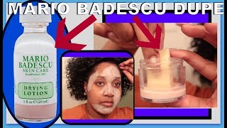 Mario Badescu Drying Lotion DUPE  How To Dry Out Pimples Fast AF [upl. by Munshi]