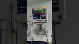 NIV ventilator support hospital icu [upl. by Ehcnalb]