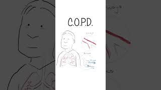 COPD  Explained healthsketch shorts [upl. by Yarised323]