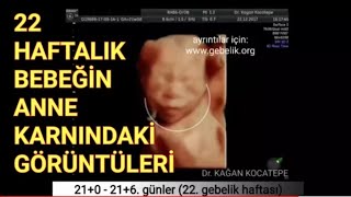 22 haftada anne karnındaki bebeğin dört boyutlu ultrason görüntüleriDr Kağan Kocatepe [upl. by Arianne305]