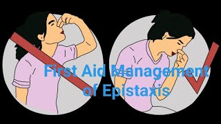 Nursing Foundation Topic First Aid Management of Epistaxis [upl. by Nirrad]