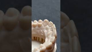 INCROYABLE  Cette Machine Reproduit la Forme des Dents 😱shorts dental formlabs 3dprinting [upl. by Einhorn]