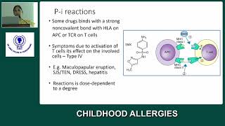 Childhood Allergies by Dr Dhanushka Dassanayake amp Professor P K Vedanthan [upl. by Adaurd]