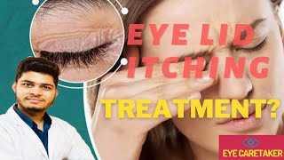 Eye itching causetreatmentBlepharitis Treatmentआखों की खुजली का इलाज [upl. by Jewell]