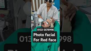 Red face laser treatmentlaser face treatmentlaal face ka treatmentdoctor [upl. by Yerrok21]