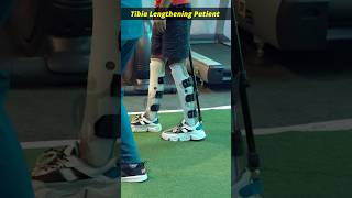 Limb lengthening surgery  Tibia lengthening surgery  heightincrease heightsurgery [upl. by Michi]