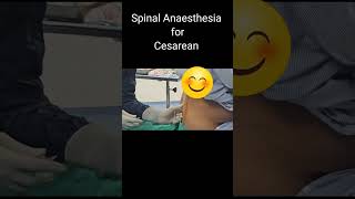 सीजेरियन में कमर में सुई लगाकर कैसे बेहोश करते हैं  Spinal Anaesthesia by Dr Manoj Kathariya [upl. by Bael]