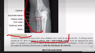 OBLÍQUA EXTERNO DO COTOVELO [upl. by Tracie]