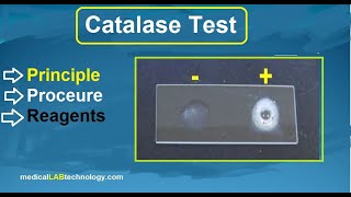 catalase test principle procedure microbiology  بالعربي labtech trendingshorts viralvideo [upl. by Mercedes]