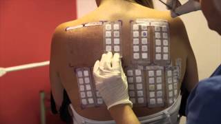 Skin Allergy Testing Using Patch Tests [upl. by Enitnelav]