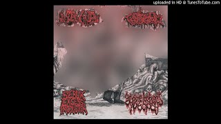 Gruesome Bodyparts Autopsy  Inopexia  Sebum Excess Production  Endotoxaemia  Split [upl. by Lucius]